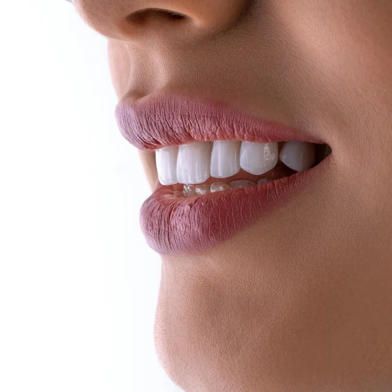 A beautiful smile crafted and maintained with experience.
